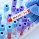 Έλεγχος βιταμίνης D και Β12: Γιατί είναι τόσο συχνές οι ελλείψεις; Οδηγός από το EV-ANALYSIS