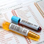 Πρόληψη & check-up: Ποιες εξετάσεις χρειάζονται σε κάθε ηλικία; Οδηγός από το EV-ANALYSIS